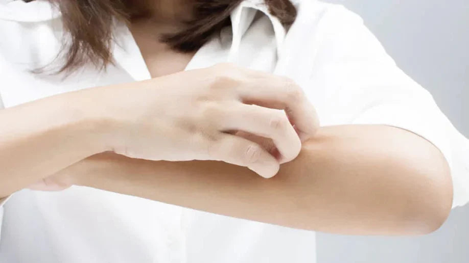 Psoriasi in estate: consigli utili per la pelle