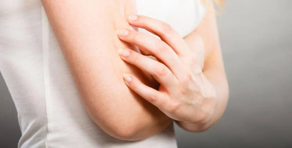 Dermatite da contatto