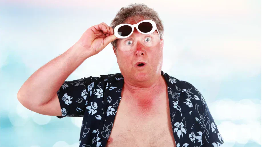 Sintomi dell'eritema solare