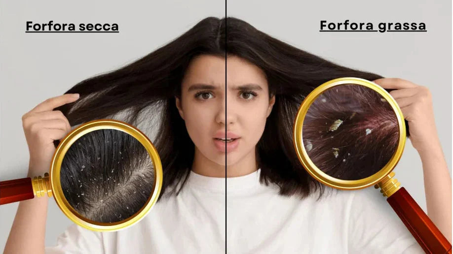 Forfora: Scopri le cause, risolvi il problema