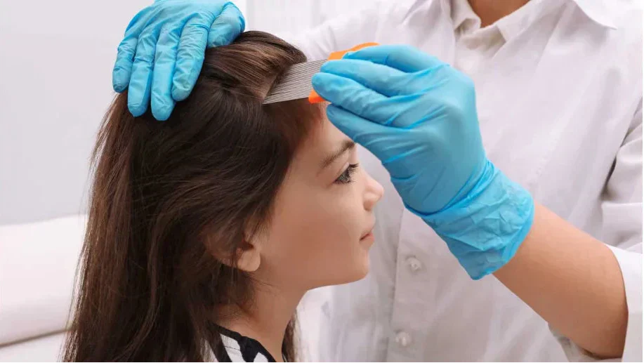 Pidocchi della Testa: la guida completa per eliminarli