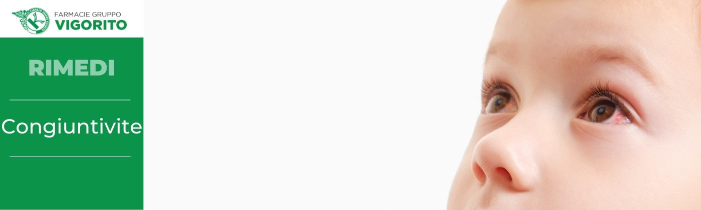 Congiuntivite