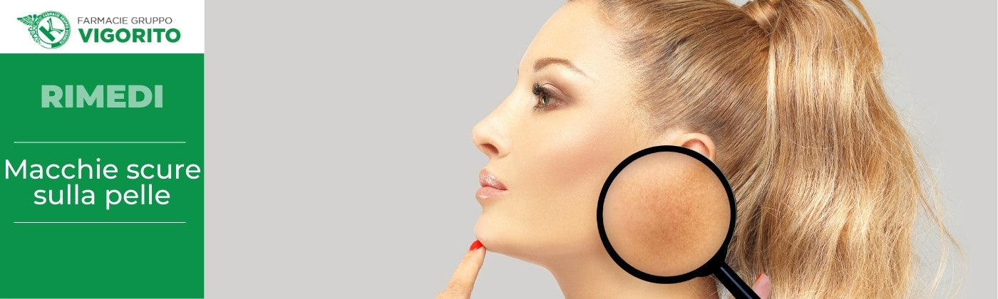 Macchie scure sulla pelle