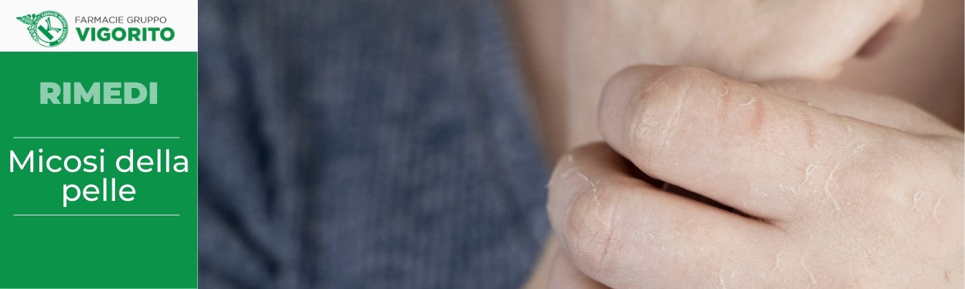 Micosi della pelle