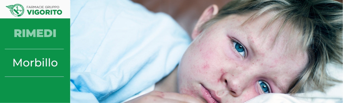 Morbillo