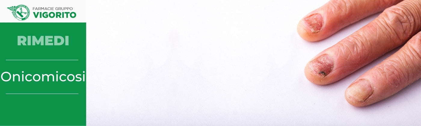 Onicomicosi