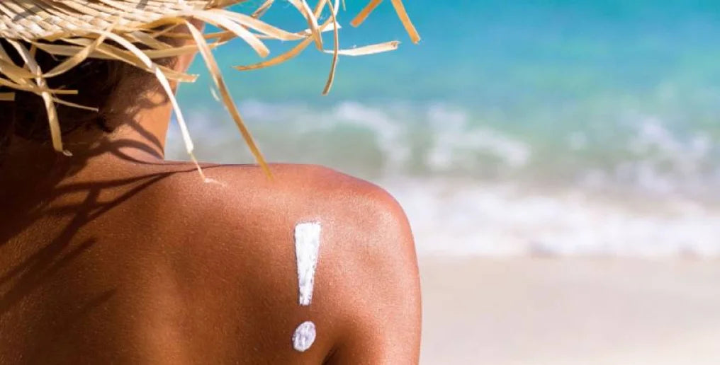 Scottature solari, prevenzione e rimedi