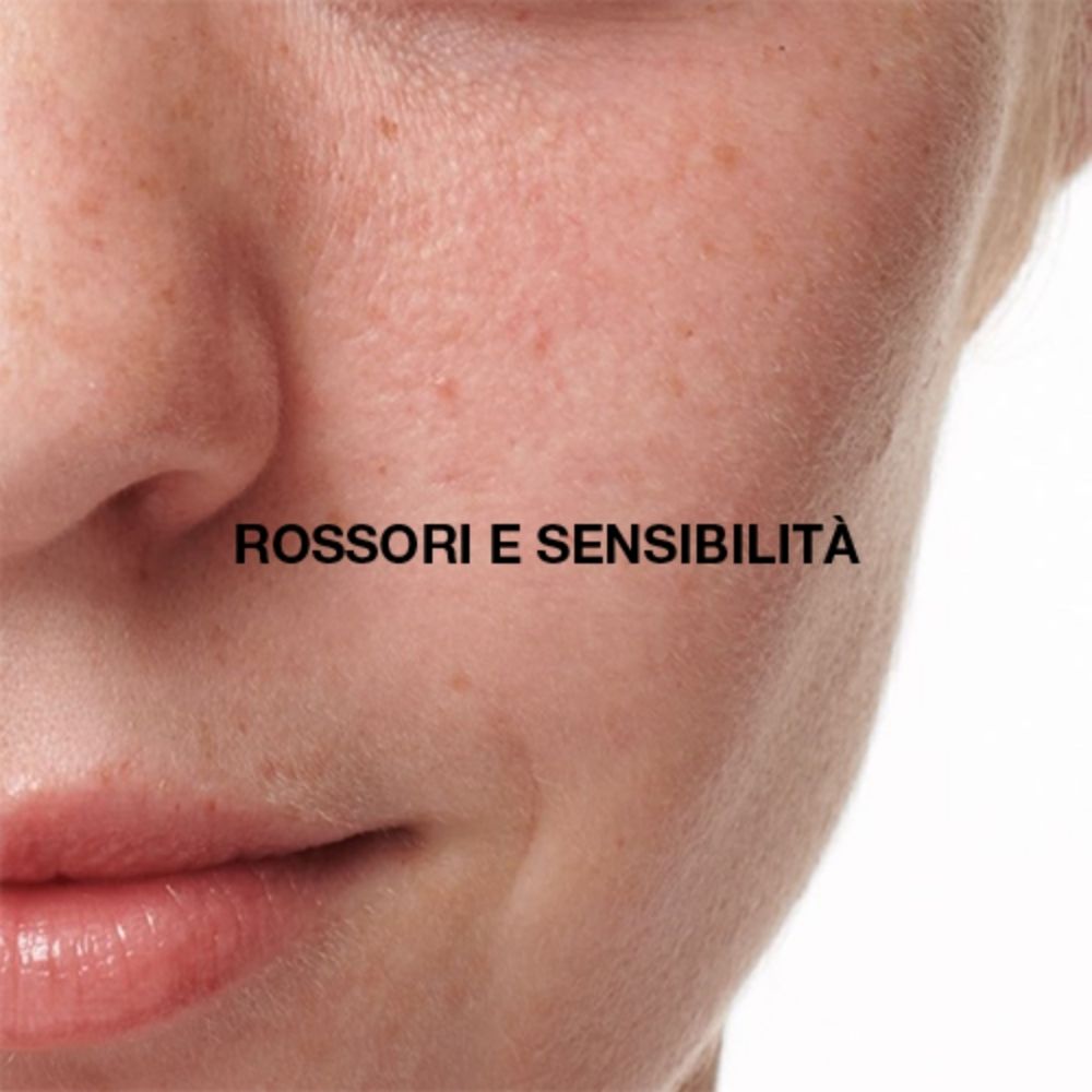Dr. Jart+ soluzioni per rossori e pelle sensibile