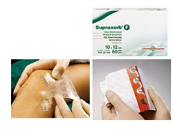 SUPRASORB F 10X12CM 10PZ
