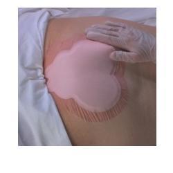 ALLEVYN SACRUM 22,5X22,1 10PZ  