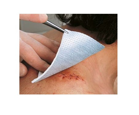 METALLINE MEDIC 8X10CM 10PZ