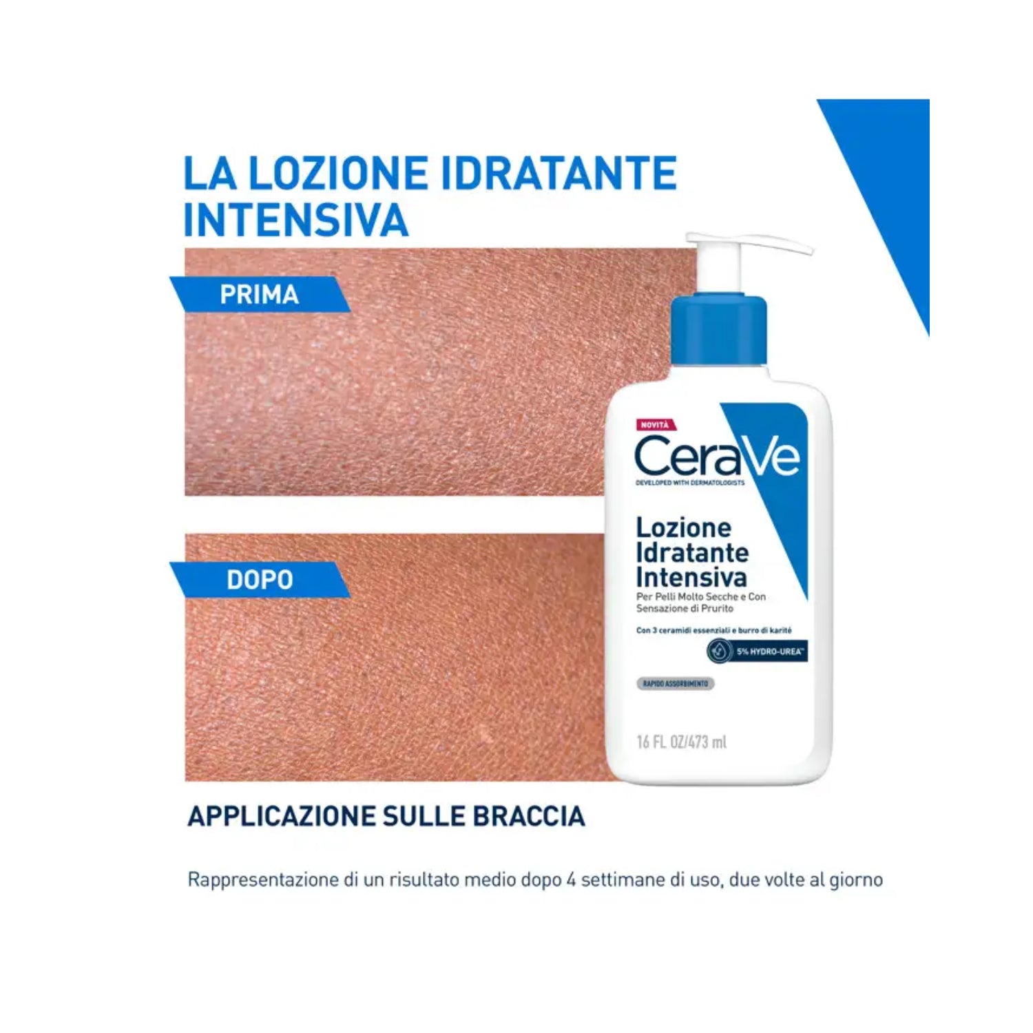 CeraVe | Lozione Idratante Intensiva Viso Corpo Pelle Molto Secca 5% Hydro-Urea | 236ml 4