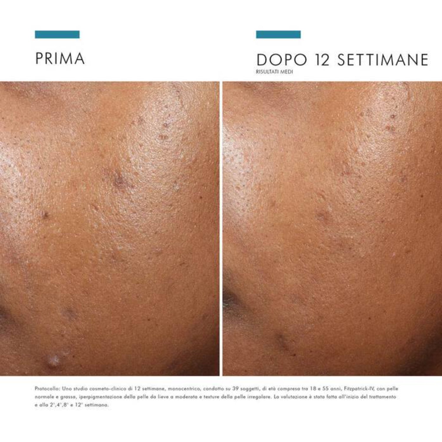 SkinCeuticals Phyto A+ Brightening Treatment | Crema Viso Illuminante Oil-Free Pelle Grassa | 30ml 6