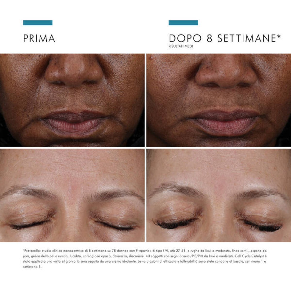 SkinCeuticals Cell Cycle Catalyst | Siero Viso Esfoliante Multi-Acidi Soft Peeling | 30ml 6 