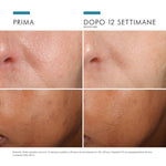 SkinCeuticals Phloretin CF | Siero Viso Antiossidante Vitamina C 10% Floretina Anti-Macchie | 30ml 5 