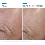 SkinCeuticals C E Ferulic | Siero Antiossidante Vitamina C 15% | 30 ml 6 