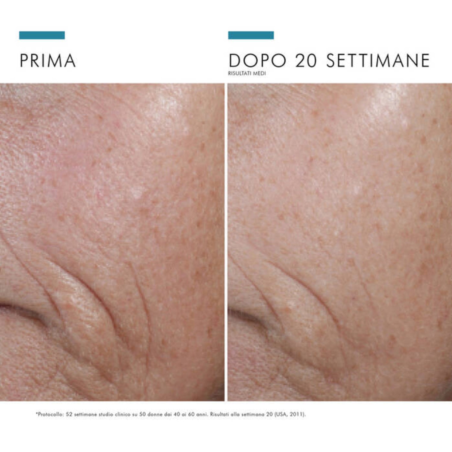 SkinCeuticals C E Ferulic | Siero Antiossidante Vitamina C 15% | 30 ml 6