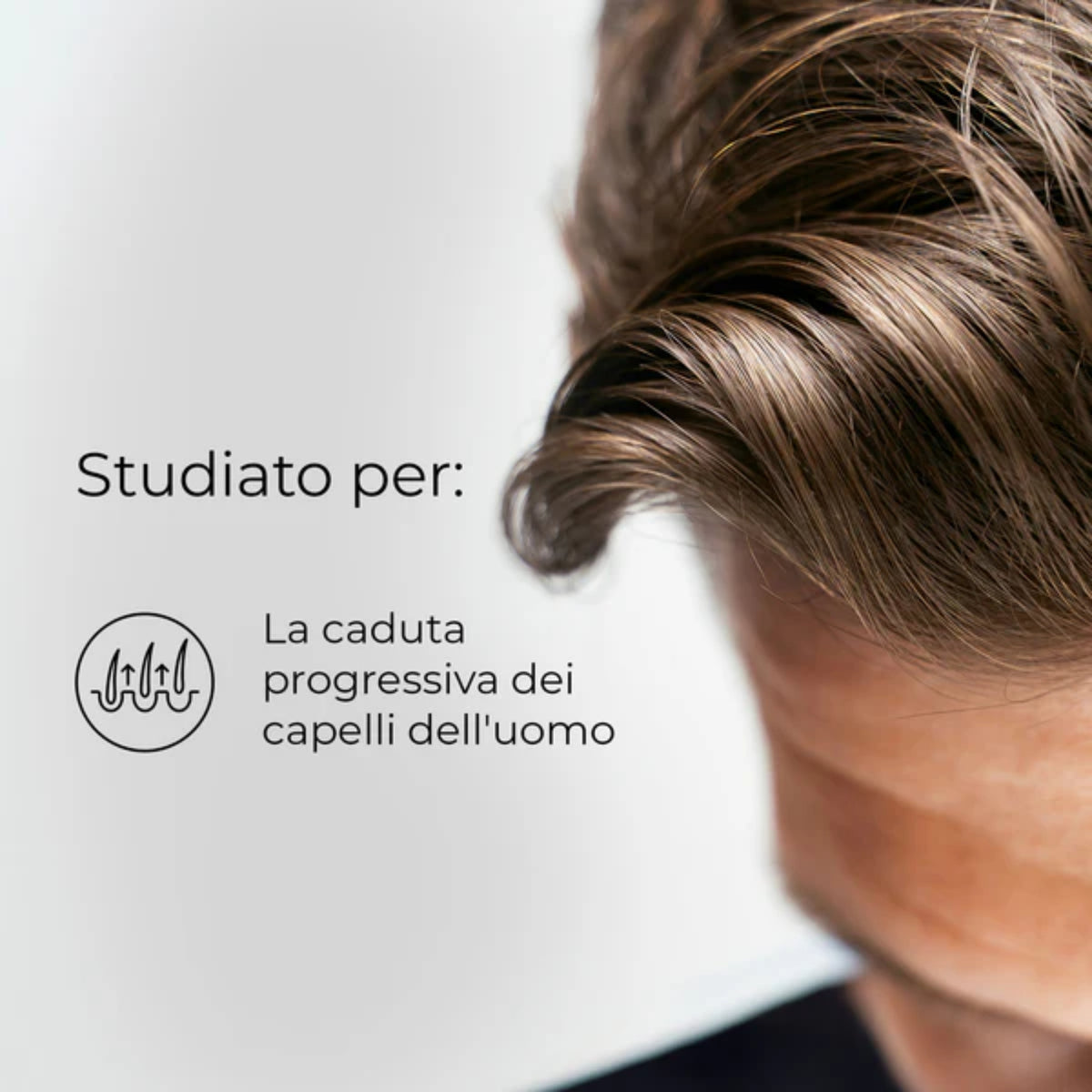Bioscalin Pro Density cera esigenze capelli uomo diradati