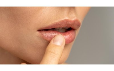 Labbra screpolate: cause e rimedi