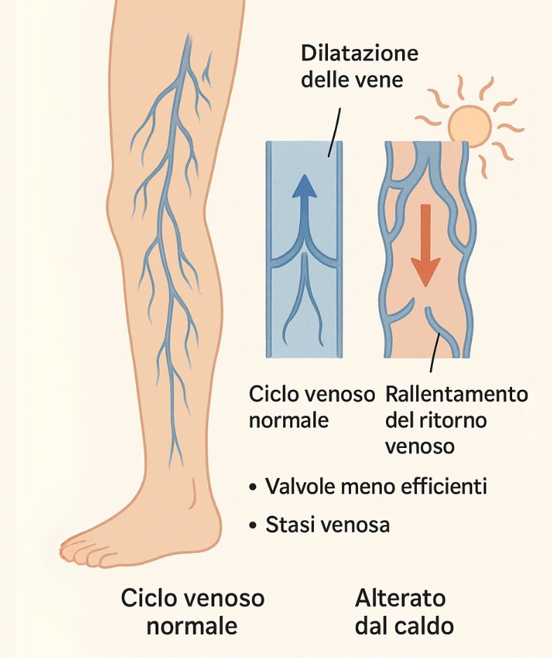 cause delle gambe pesanti in estate cause delle gambe pesanti in estate