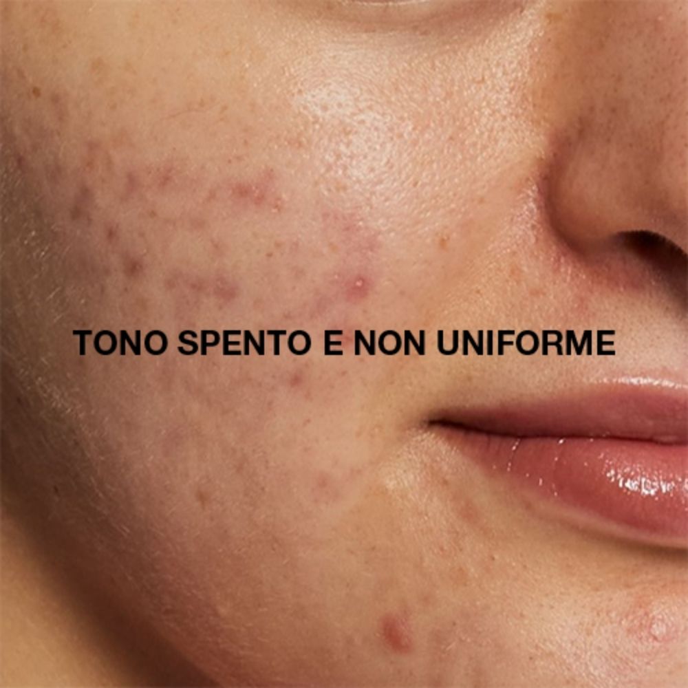 Dr Jart+ Soluzioni per Tono Spento e Non Uniforme